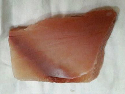 中华奇石-----东陵玉  第4张