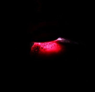 顶级鸽血红宝石赏析  第2张