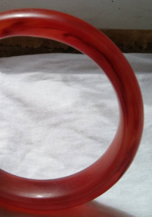 红玛瑙手镯竟然有这些治疗保健作用！  第4张